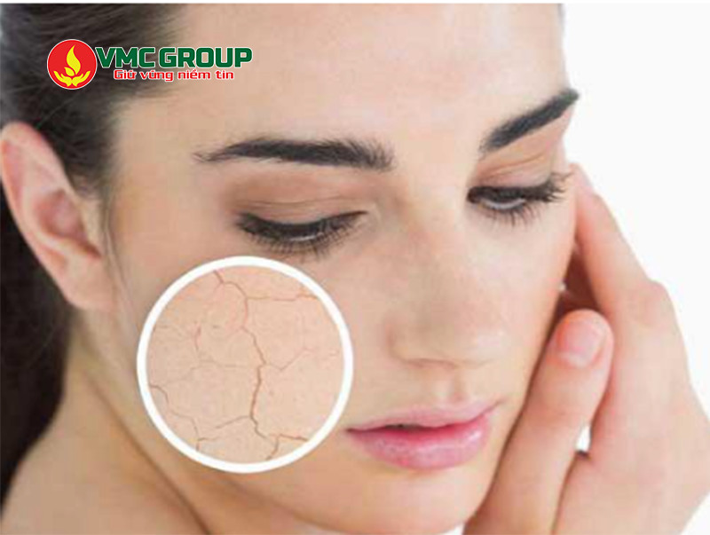 Vitamin C trong mỹ phẩm giúp da dưỡng ẩm, tránh khô ráp