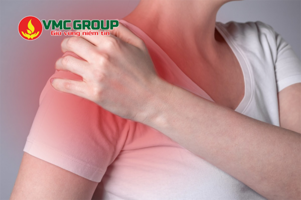 MgCl2 được dùng trong điều trị đau xương khớp